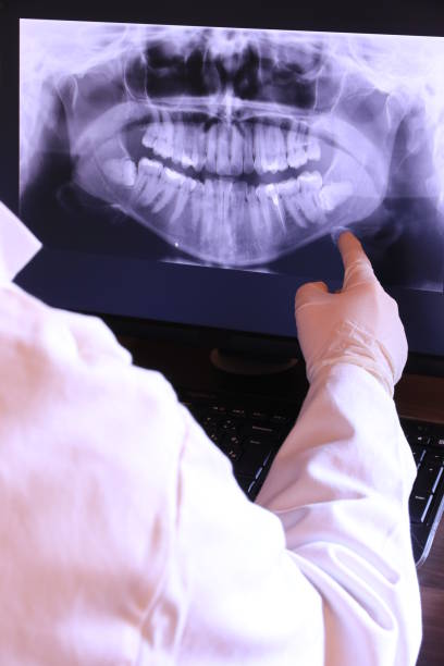 Best Emergency Wisdom Teeth Removal in Littlefield, TX